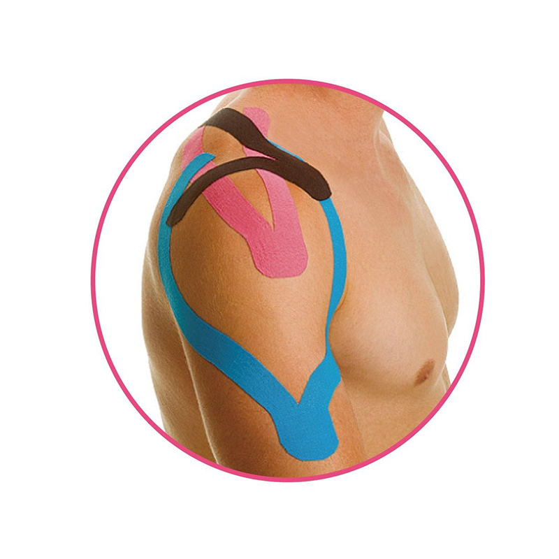 Kineziológiai tapasz I. típus